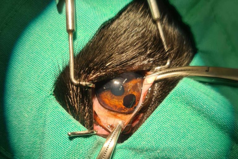 Diode laser for uveal cysts and melanoma