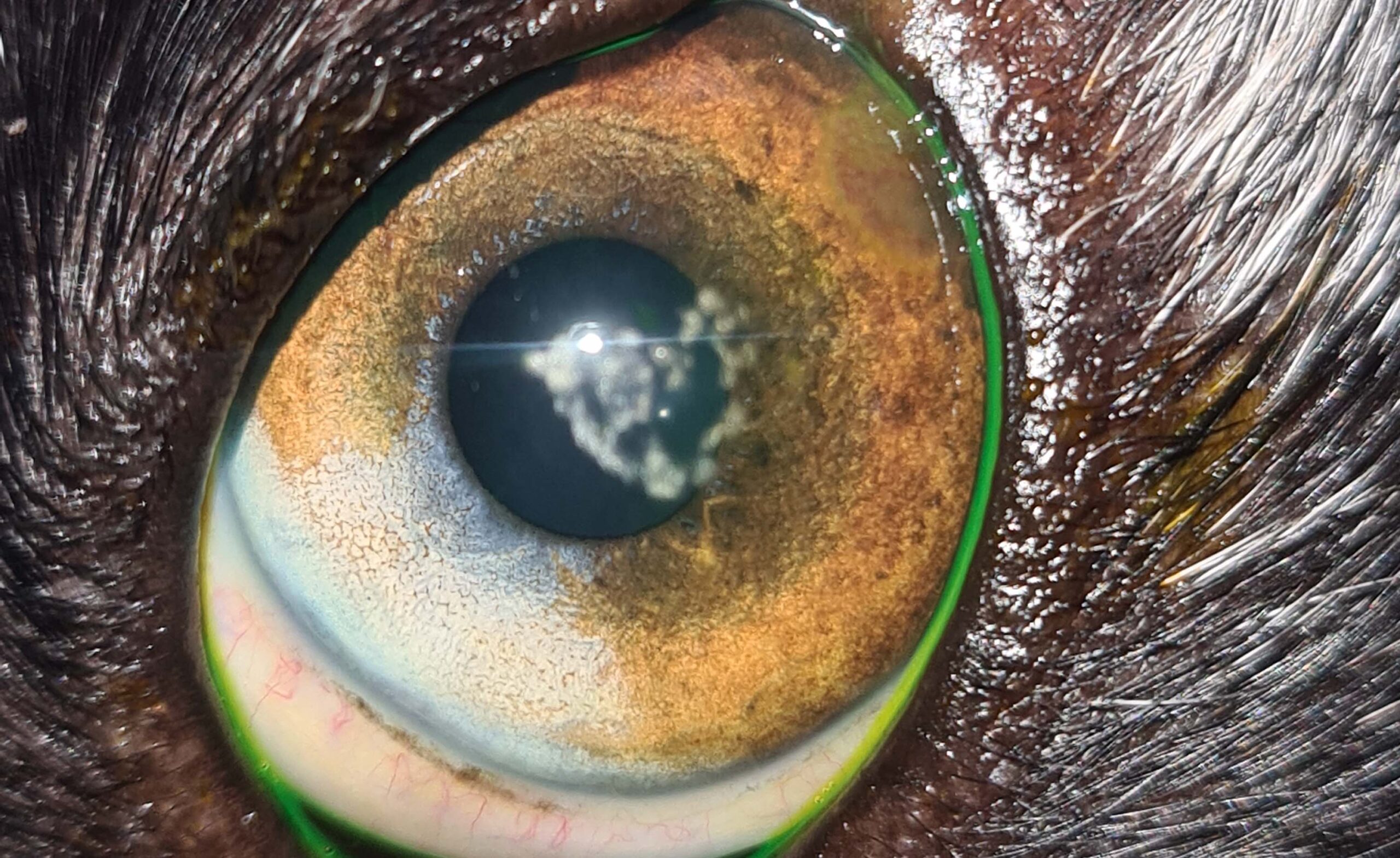 corneal lesion
